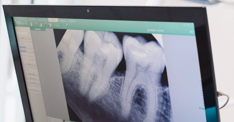 Close-up of a dental x-ray displayed on a monitor in a dental office.
